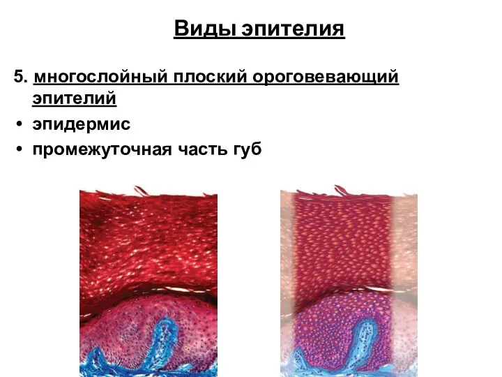 Виды эпителия 5. многослойный плоский ороговевающий эпителий эпидермис промежуточная часть губ